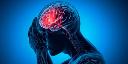 Best Neurovascular Specialist in Chembur